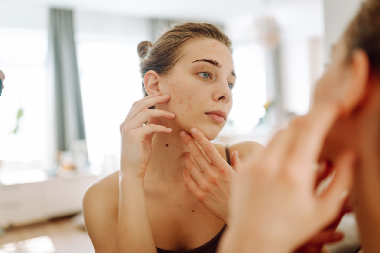 De piel seca a piel con imperfecciones: Cómo encontrar el sérum perfecto para ti